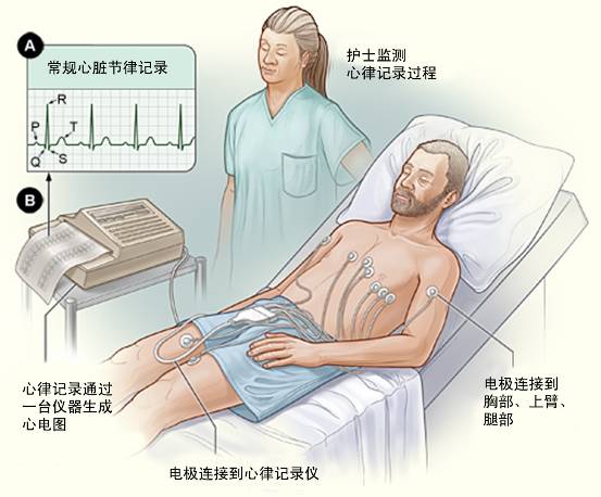 冠心病需要做哪些檢查？(圖1)