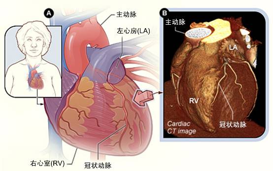 冠心病需要做哪些檢查？(圖2)